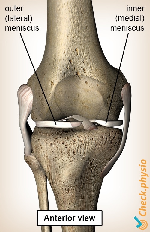 medial meniscus tear