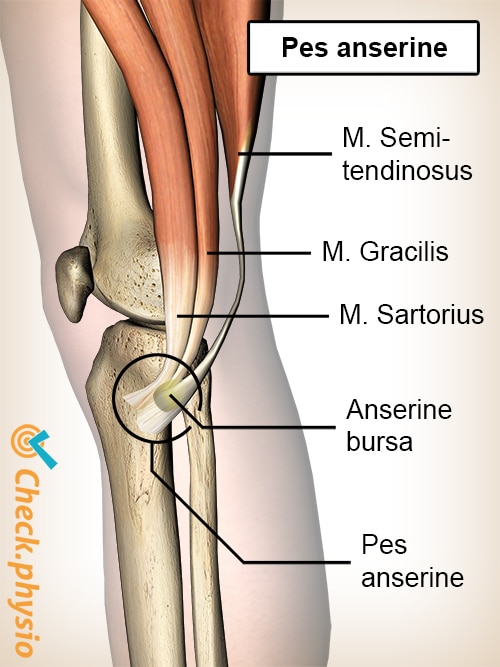 Muscle injury of the upper back