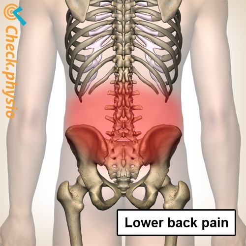 Lower Back Pain: What Could It Be?