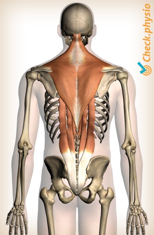 Muscle injury of the upper back