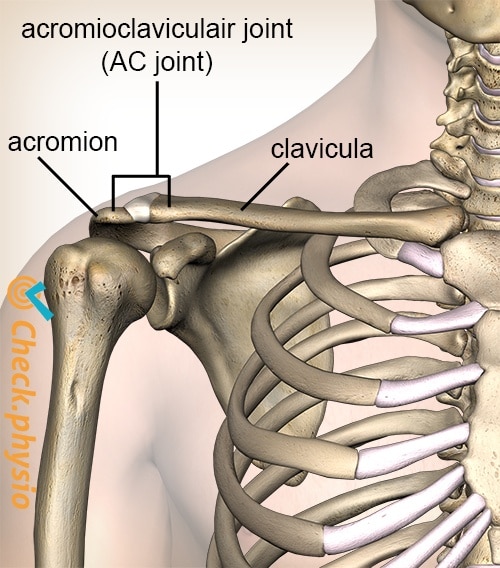 Muscle injury of the upper back