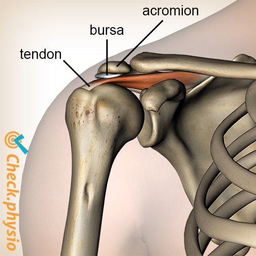 shoulder impingement bursa supraspinatus