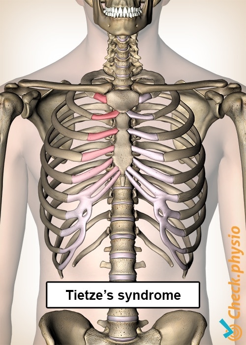 Is Chest Pain Bothering You? Here Are Its Symptoms, Causes And