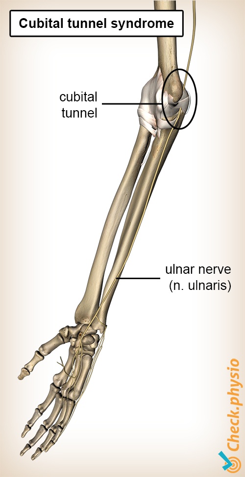 arm cubital tunnel ulnar nerve