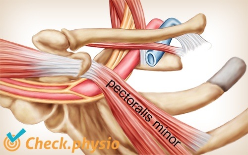 shoulder arm hand thoracic outlet syndrome pectoralis minor