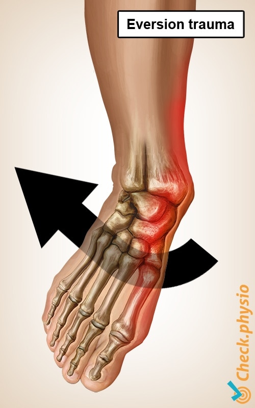 medial ankle ligaments