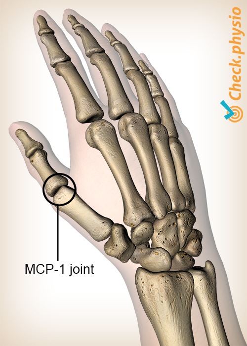 hand mcp 1 thumb