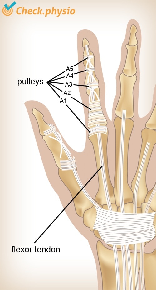 Muscle injury of the upper back