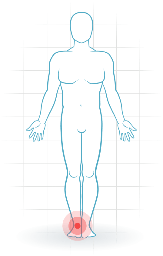 pijnlocatie Ankle instability
