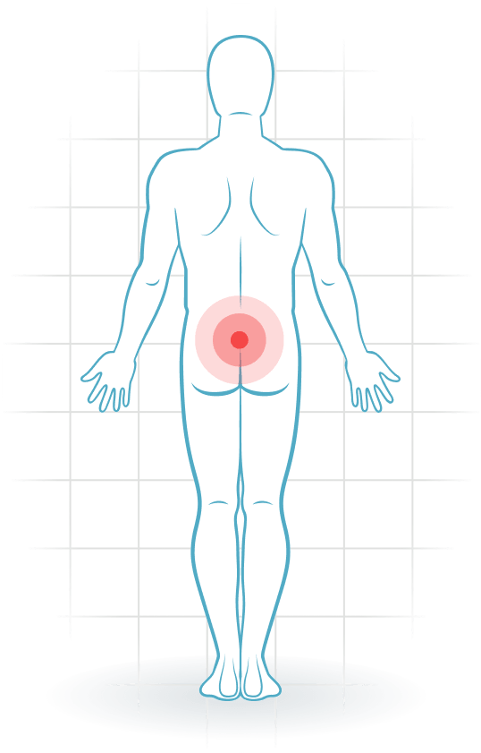 pijnlocatie SI joint pain