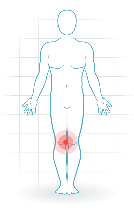 pijnlocatie Medial knee ligament injury