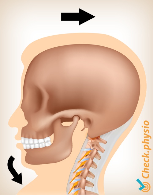 neck whiplash pain movement 1