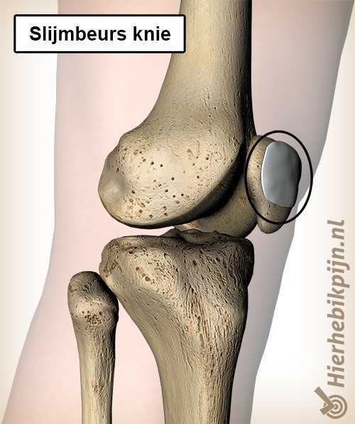 Knie slijmbeurs